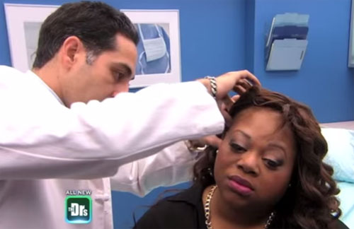 countess vaugn hair loss